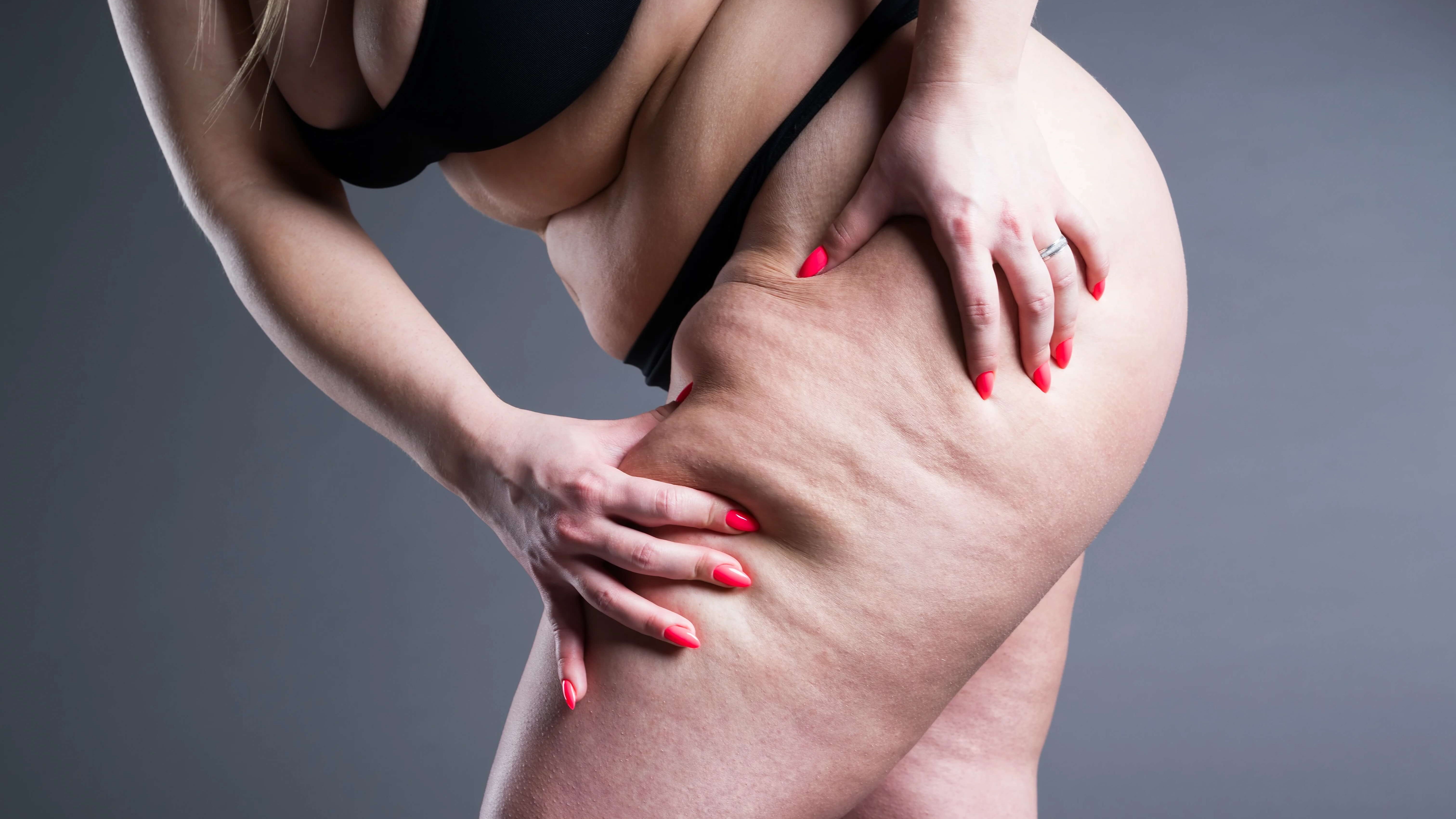 woman grabbing her leg